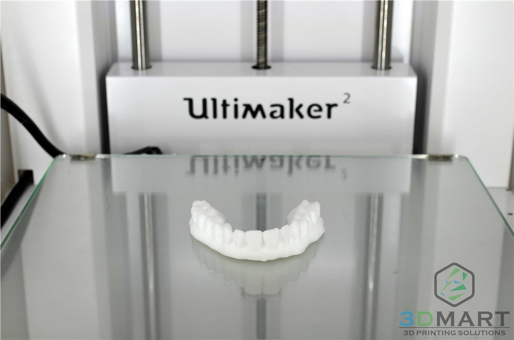 3D列印，牙齒，齒模，HIPS,