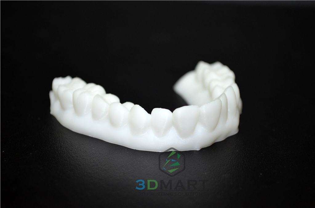 3D列印，牙齒，齒模，HIPS, ULTIMAKER2