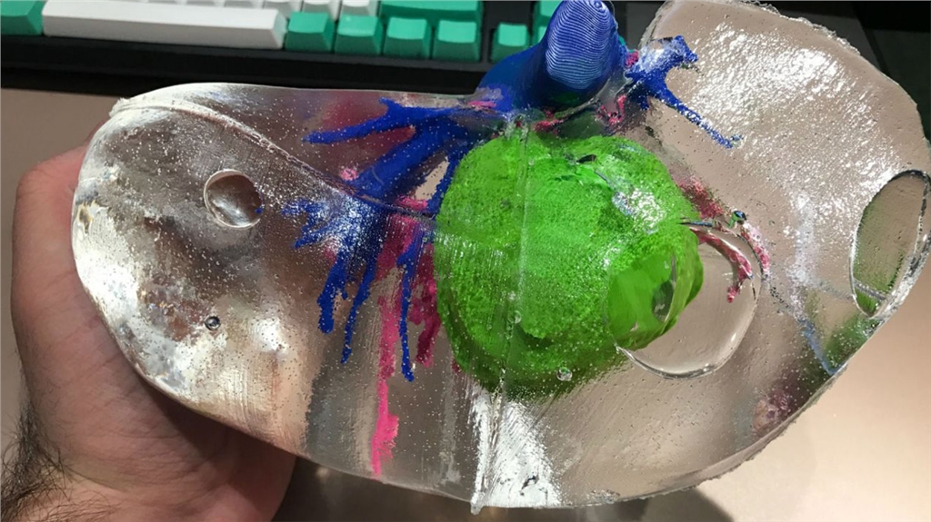 3D列印矽膠肝臟模型